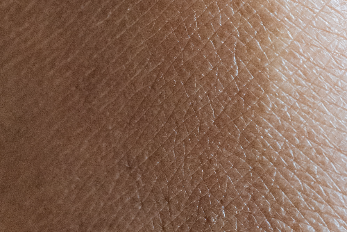 Can Opzelura be used with Dupixent?