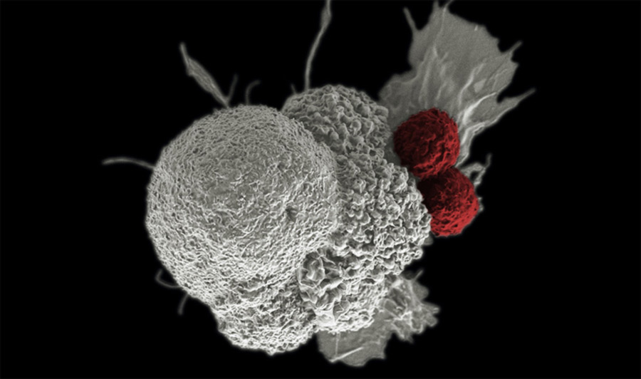 New Acute Myeloid Leukemia Treatments 2022