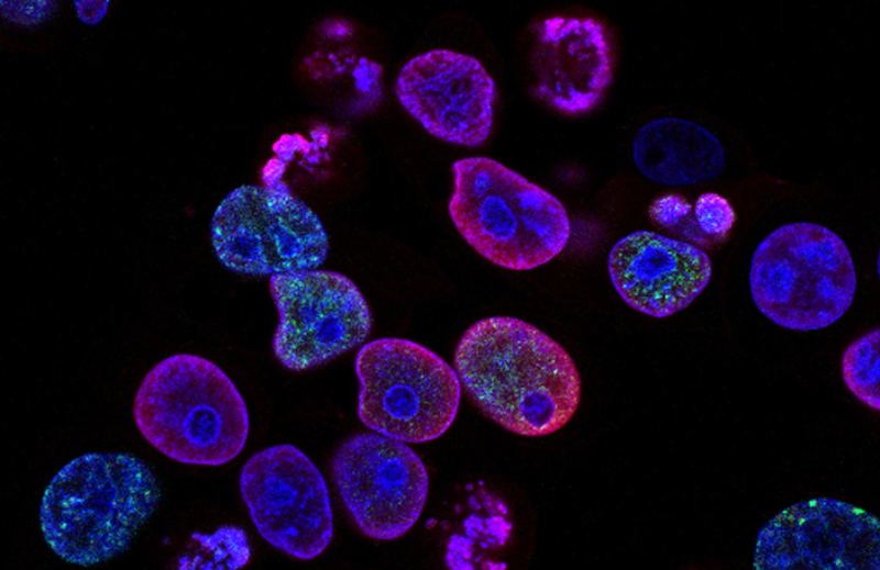 Can Enhertu treat colorectal cancer? Latest results, approval timelines, and more.