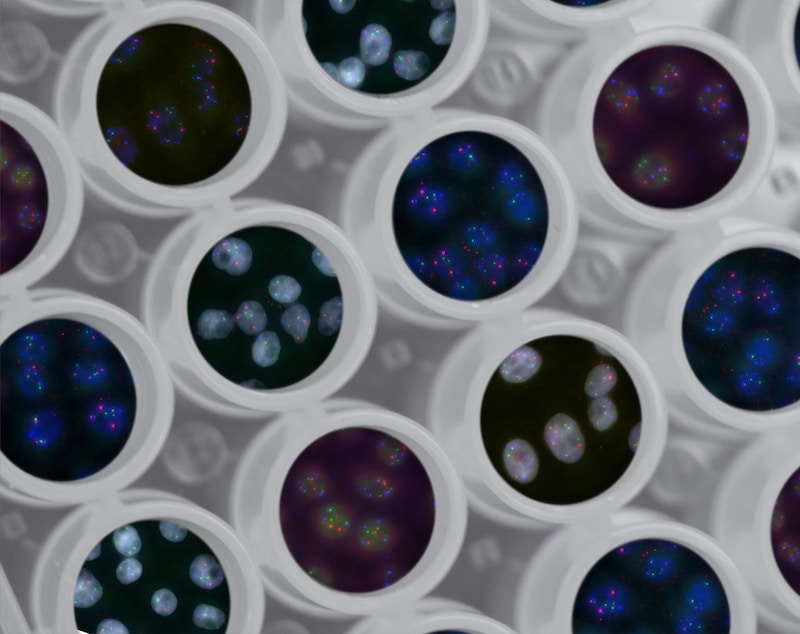 Leniolisib's EMA approval: How to prevent delays from delaying your treatment