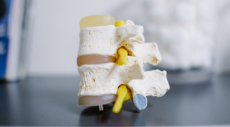 New Multiple Myeloma Treatments 2022