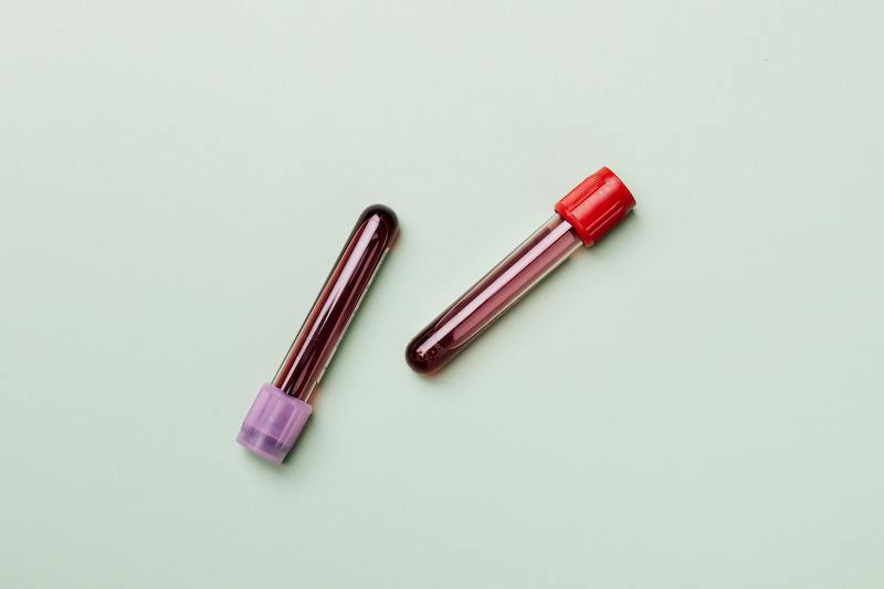 Linvoseltamab's approval by the EMA (and FDA): How long will you have to wait?