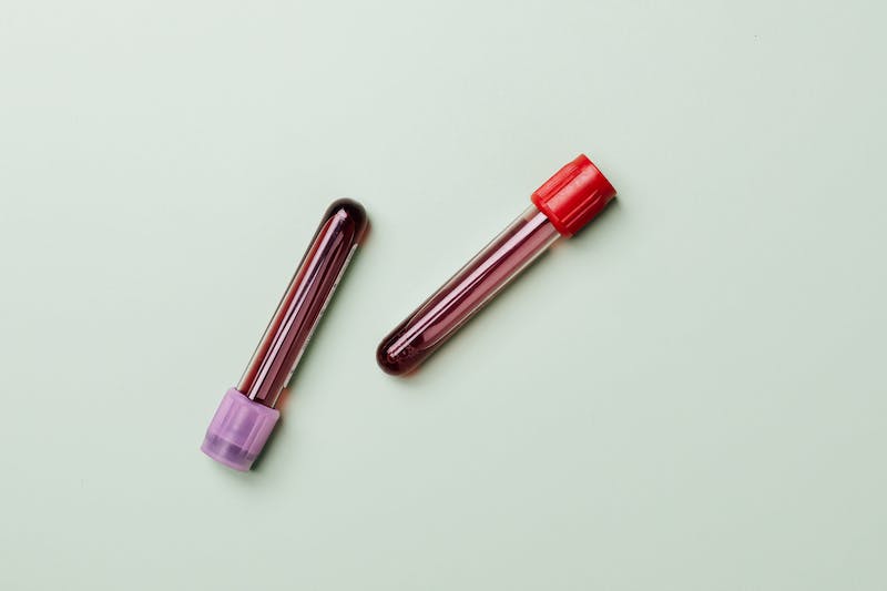 When will momelotinib be approved in Europe and the UK?