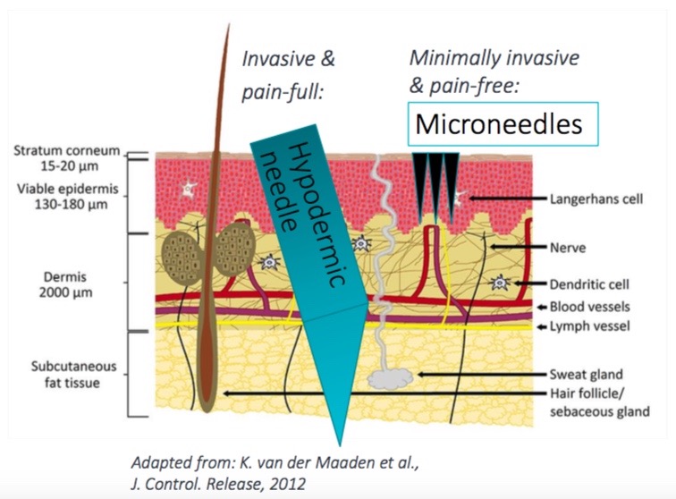 Microneedles