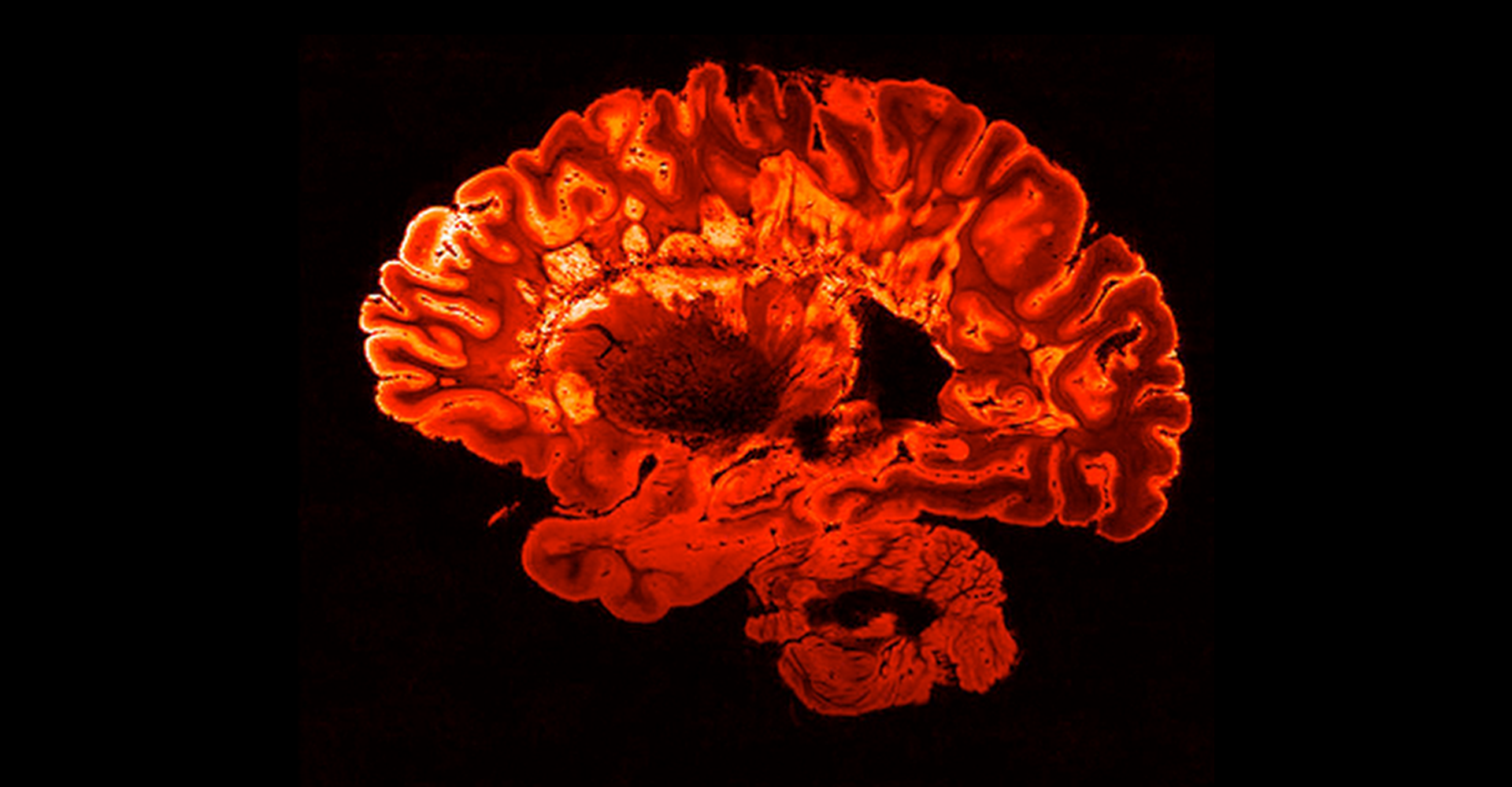 Red MRI Brain Scan red mri brain scan
